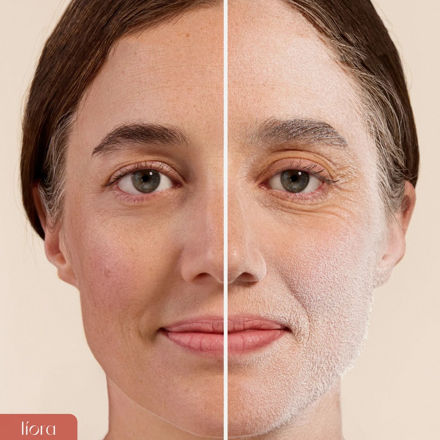 Liora Dermaplane Prep Mist 02Antesedepois