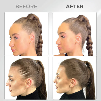 Líora Hair — before and after, baby hairs on medium brown hair