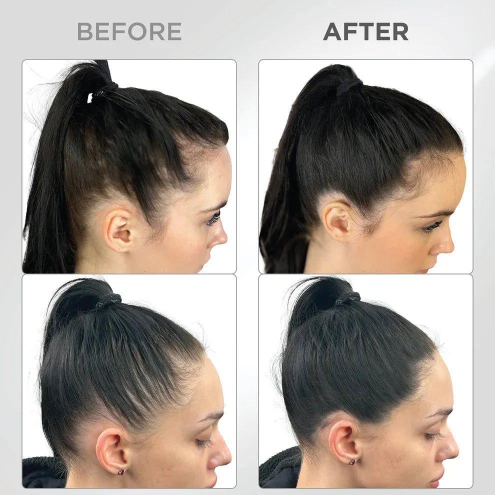 Líora Hair — before and after, side hairline on black hair