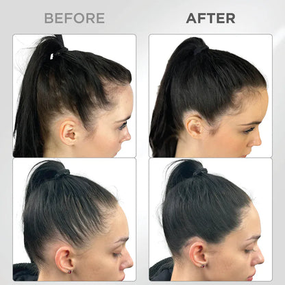 Líora Hair — before and after, side hairline on black hair