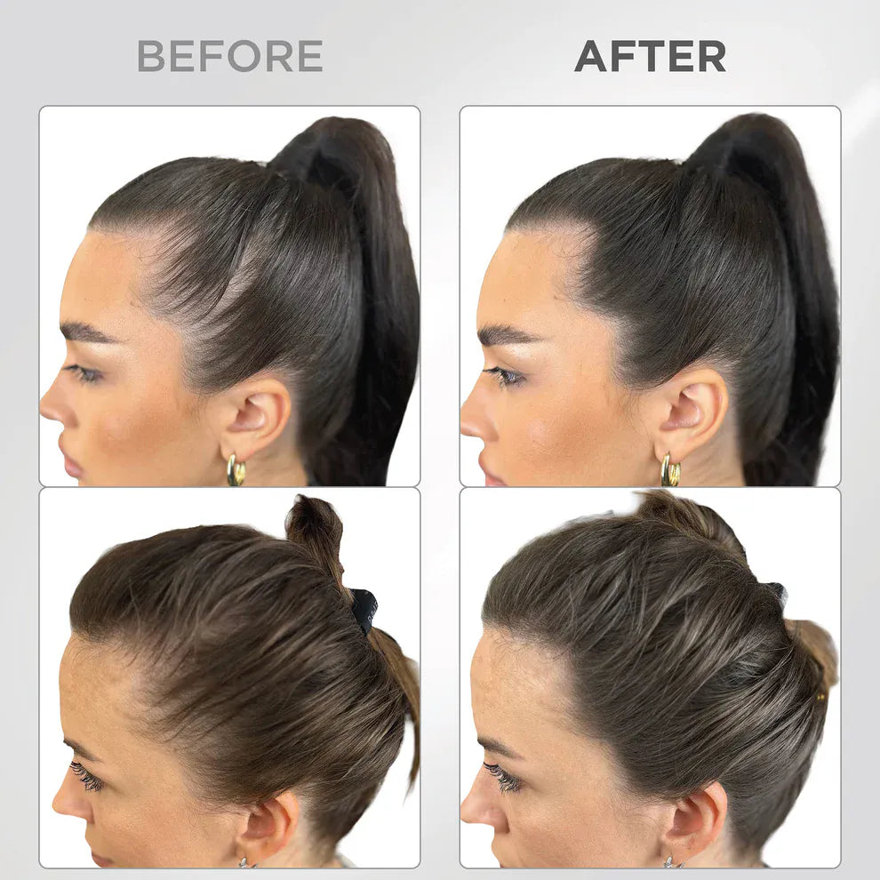Líora Hair — before and after, hairline on dark brown hair