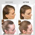 Líora Hair — before and after, hairline fill on golden brown hair