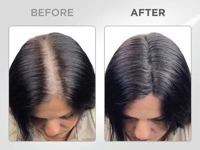Líora Hair — before and after, parting fill on black hair